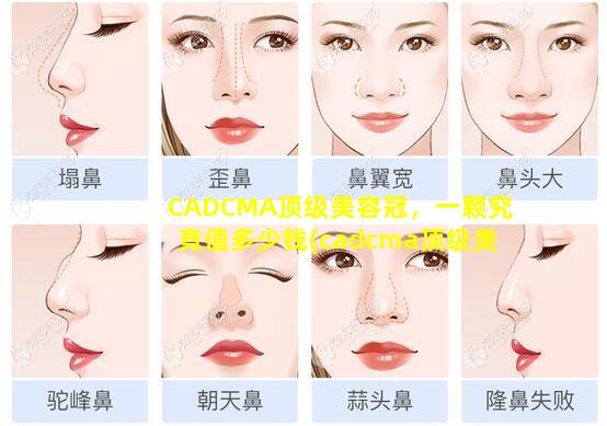 CADCMA顶级美容冠，一颗究竟值多少钱(cadcma顶级美 🌷 容冠,一颗究竟值多少钱)